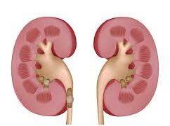 الإفراط في تناول هذا الفيتامين  يهددك بحصى الكلى