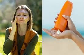 في ظل حرارة الصيف اللاهبة.. تدابير لمواجهة حروق الشمس