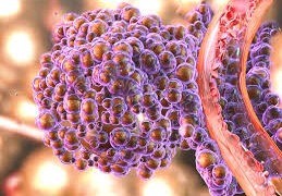 لماذا تقضي علاجات السرطان على أورام وتعجز عن أخرى؟